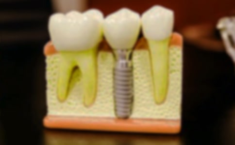 拔牙优秀作文(共15篇)